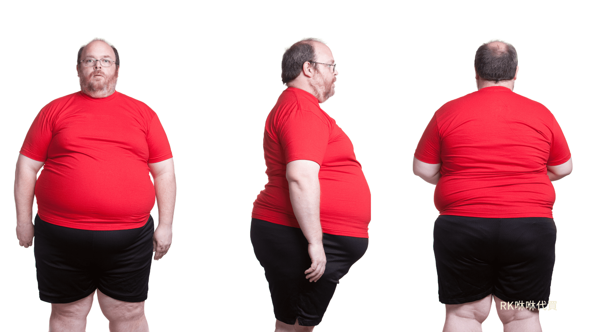 肥胖為何會造成掉髮?